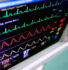 electrocardiograma