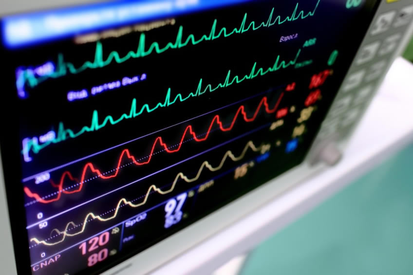 electrocardiograma