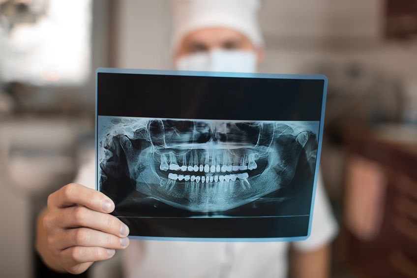radiografía panorámica dental